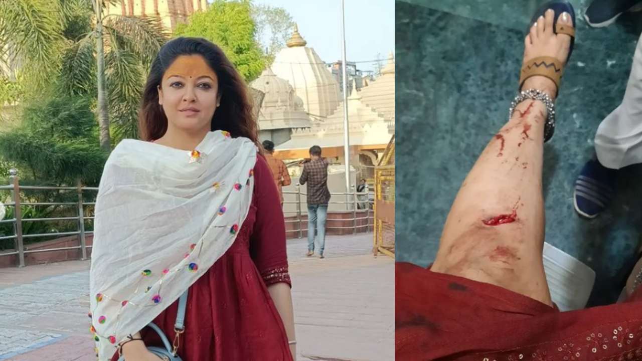 Tanushree Dutta : యాక్సిడెంట్లో గాయపడ్డ బాలీవుడ్ హీరోయిన్.. అయినా అలాగే దర్శనానికి.. Tanushree Dutta : యాక్సిడెంట్లో గాయపడ్డ బాలీవుడ్ హీరోయిన్.. అయినా అలాగే దర్శనానికి..