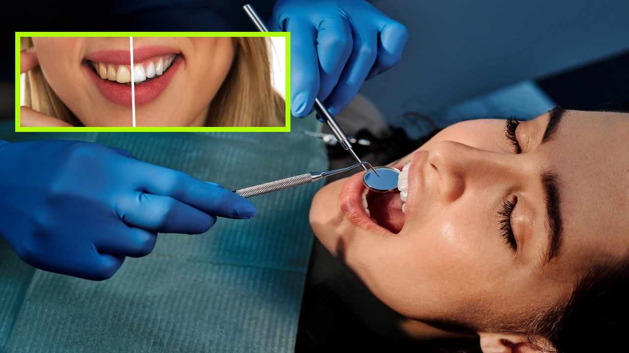 Teeth : దంత క్షయం, చిగుళ్ల వ్యాధులను కలిగించే దంతాలపై పాచి! Teeth : దంత క్షయం, చిగుళ్ల వ్యాధులను కలిగించే దంతాలపై పాచి!