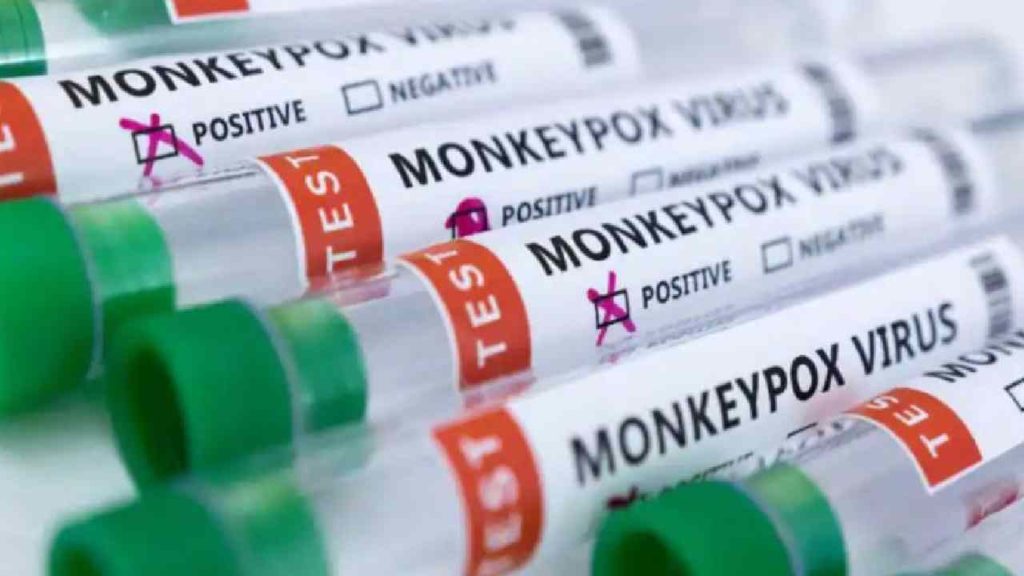 monkeypox