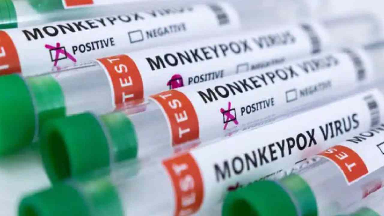 Monkeypox : యూపీలో ఐదేళ్ల చిన్నారికి మంకీపాక్స్ లక్షణాలు Monkeypox : యూపీలో ఐదేళ్ల చిన్నారికి మంకీపాక్స్ లక్షణాలు