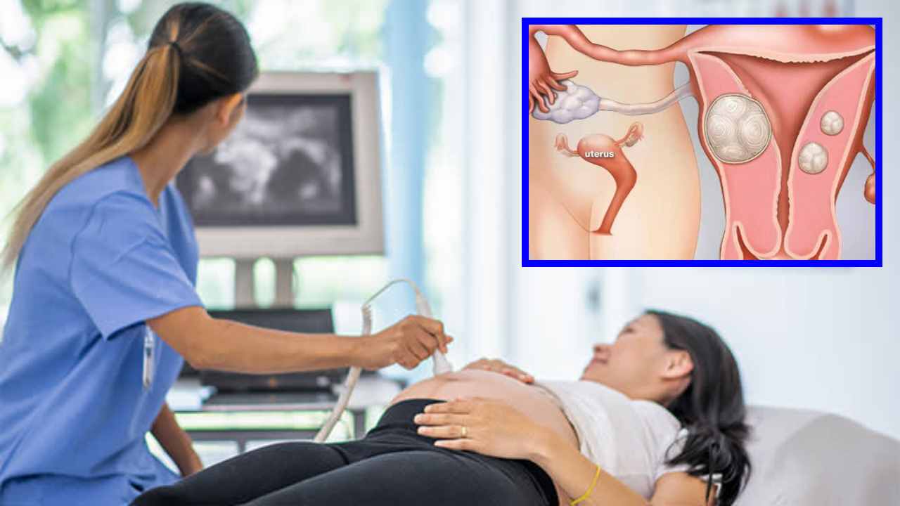 Tumors : గర్భదారణకు అడ్డంకిగా గర్భసంచిలో గడ్డలు! Tumors : గర్భదారణకు అడ్డంకిగా గర్భసంచిలో గడ్డలు!
