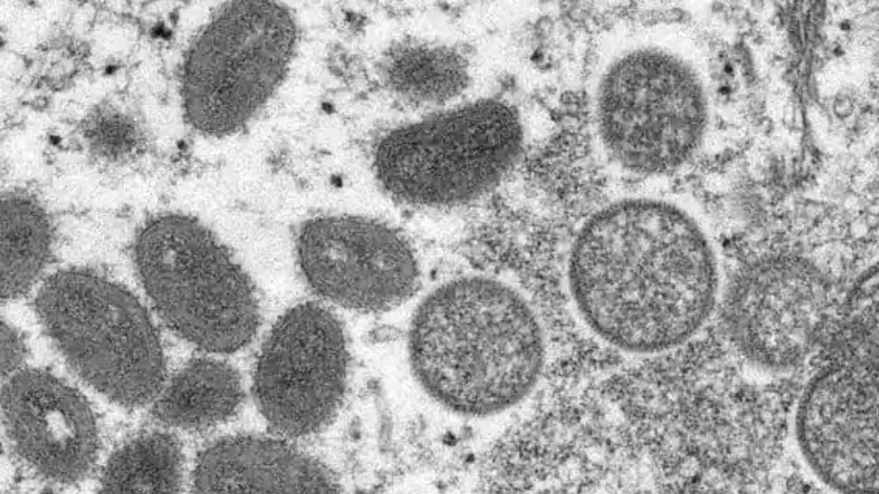 Monkeypox: స్విట్జర్లాండ్ నుంచి వచ్చిన వ్యక్తి నుంచి మరో మంకీపాక్స్ కేసు Monkeypox: స్విట్జర్లాండ్ నుంచి వచ్చిన వ్యక్తి నుంచి మరో మంకీపాక్స్ కేసు