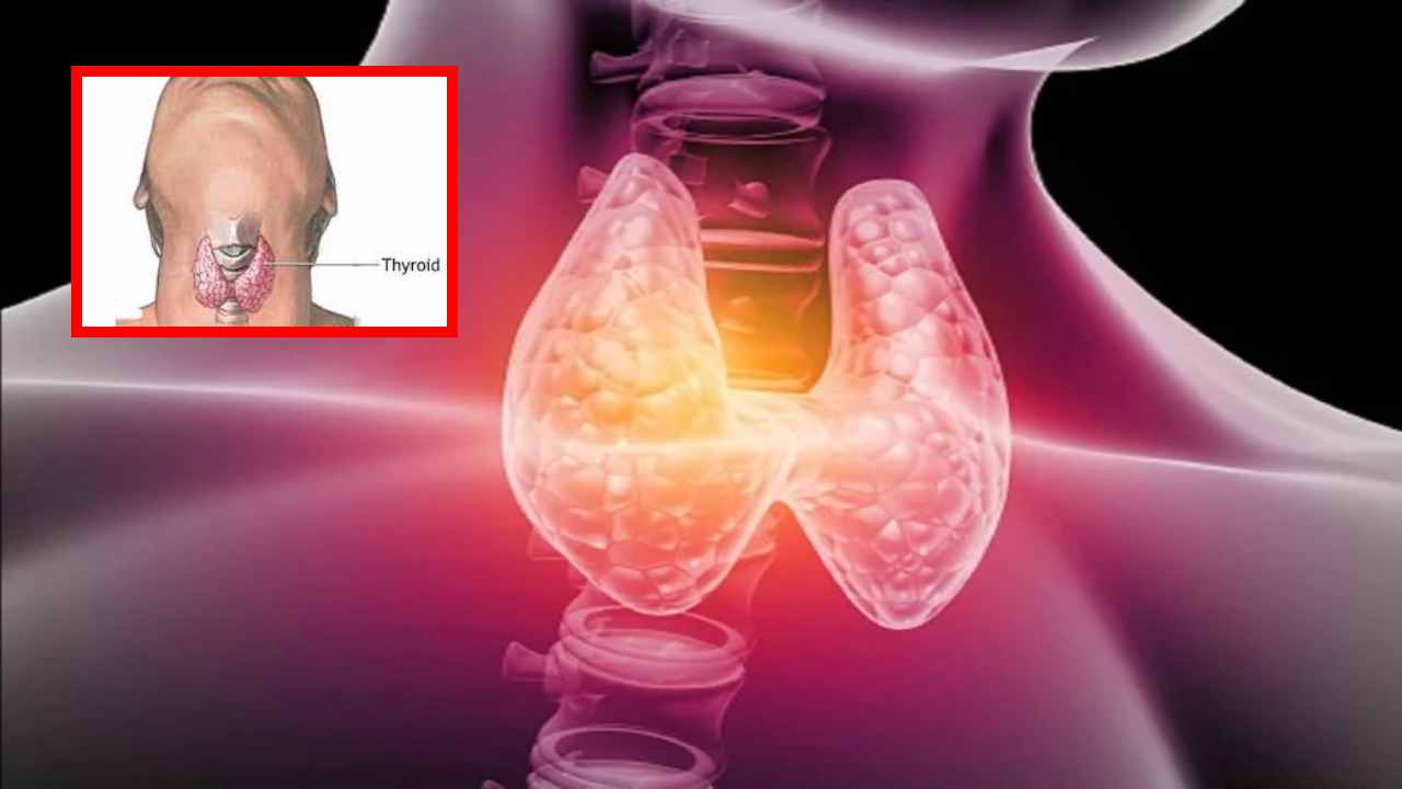 Thyroid Problems : థైరాయిడ్ సమస్యలు పురుషులలో కంటే స్త్రీలలోనే ఎక్కువా? Thyroid Problems : థైరాయిడ్ సమస్యలు పురుషులలో కంటే స్త్రీలలోనే ఎక్కువా?