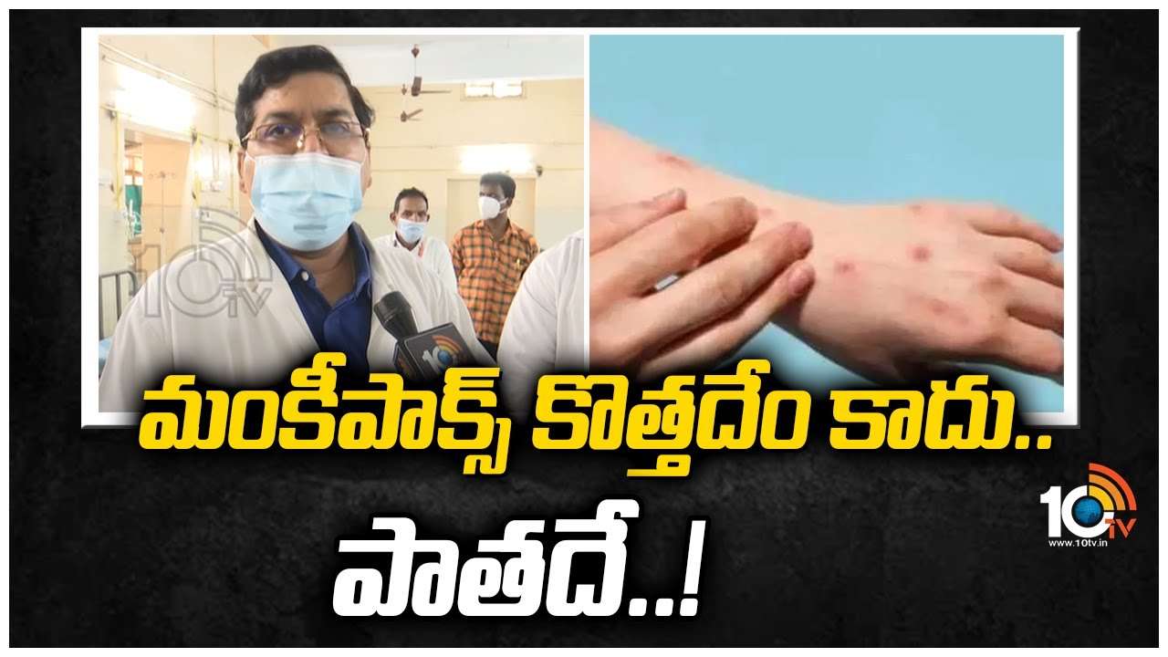 మంకీ ఫాక్స్ కొత్తదేం కాదు.. పాతదే..!