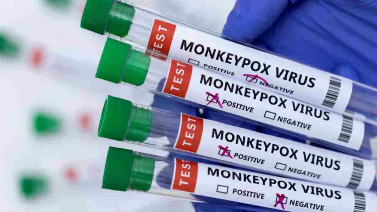 Monkeypox: హమ్మయ్య నెగిటివ్ వచ్చింది.. కామారెడ్డి యువకుడికి మంకీపాక్స్ లేదు.. Monkeypox: హమ్మయ్య నెగిటివ్ వచ్చింది.. కామారెడ్డి యువకుడికి మంకీపాక్స్ లేదు..