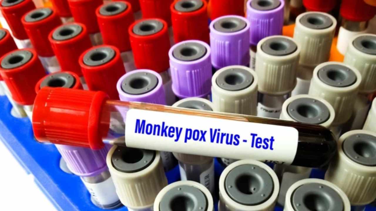 Monkeypox: ఏపీలో మంకీపాక్స్ కలకలం! Monkeypox: ఏపీలో మంకీపాక్స్ కలకలం!