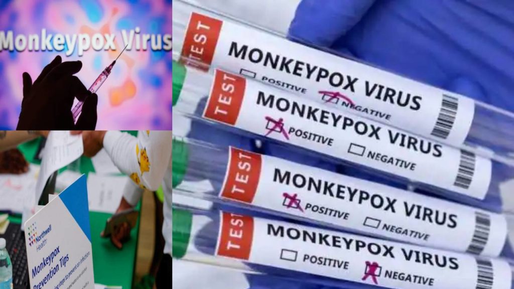 Monkeypox In Children! Us Reports Its First 2 Cases Of Viral Infection In Kids