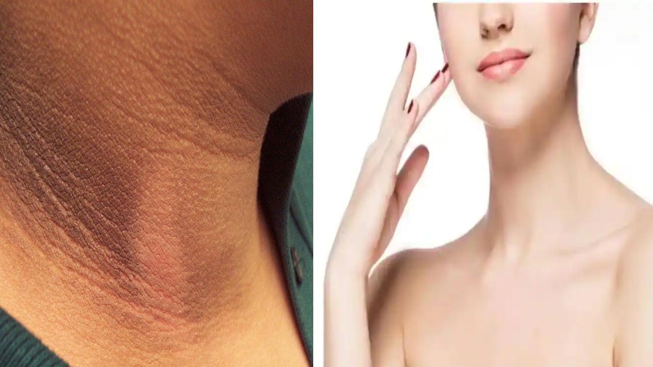 Neck Skin Tips : ఇలా చేస్తే.. మీ మెడ చుట్టూ నలుపు ఇట్టే మాయం..! Neck Skin Tips : ఇలా చేస్తే.. మీ మెడ చుట్టూ నలుపు ఇట్టే మాయం..!