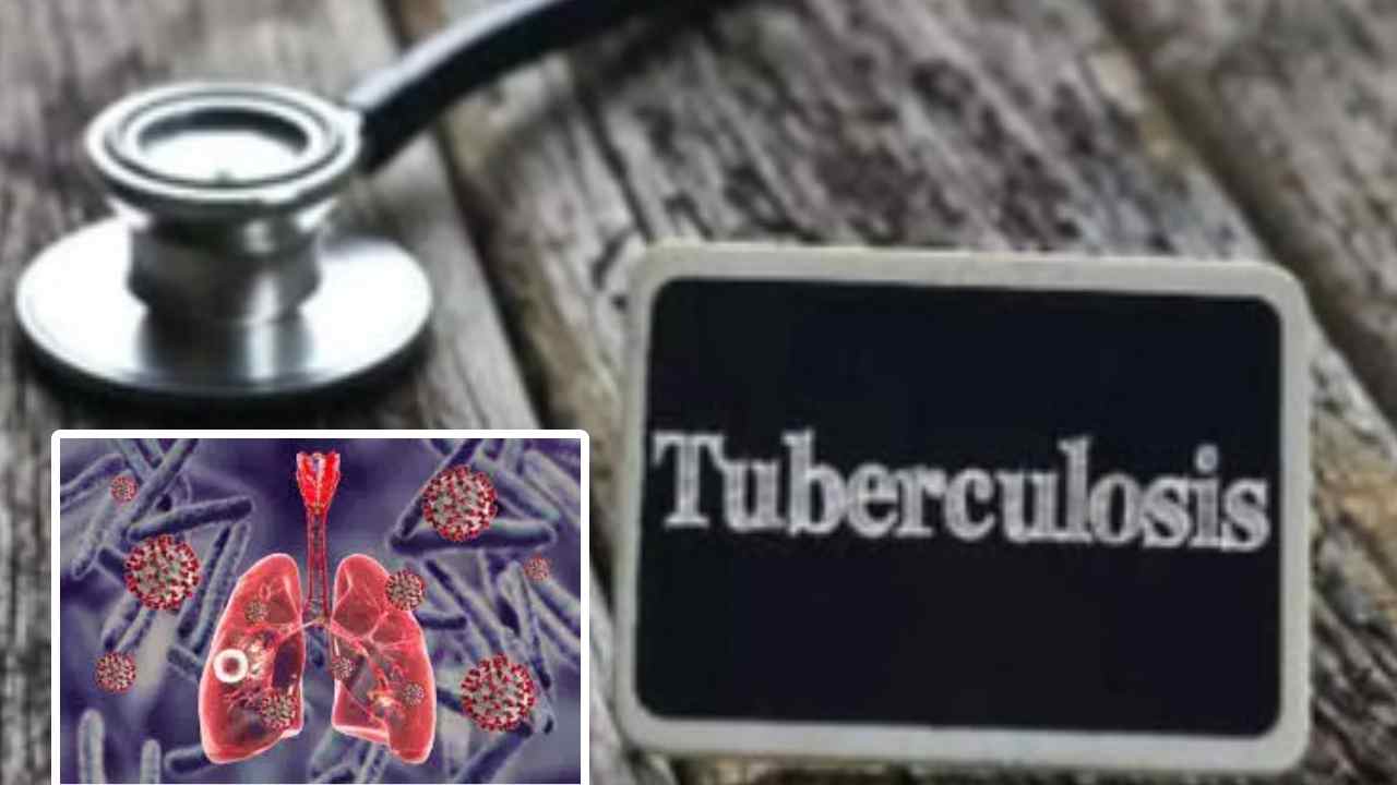 TB Patients: ఆ వ్యాధిగ్రస్తులు కోలుకున్నా ముప్పు తప్పదు.. ప్రతి ఆర్నెళ్లకు పరీక్షించుకోవాలి! TB Patients: ఆ వ్యాధిగ్రస్తులు కోలుకున్నా ముప్పు తప్పదు.. ప్రతి ఆర్నెళ్లకు పరీక్షించుకోవాలి!