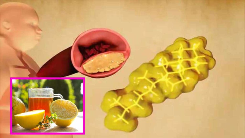 Bad Cholesterol