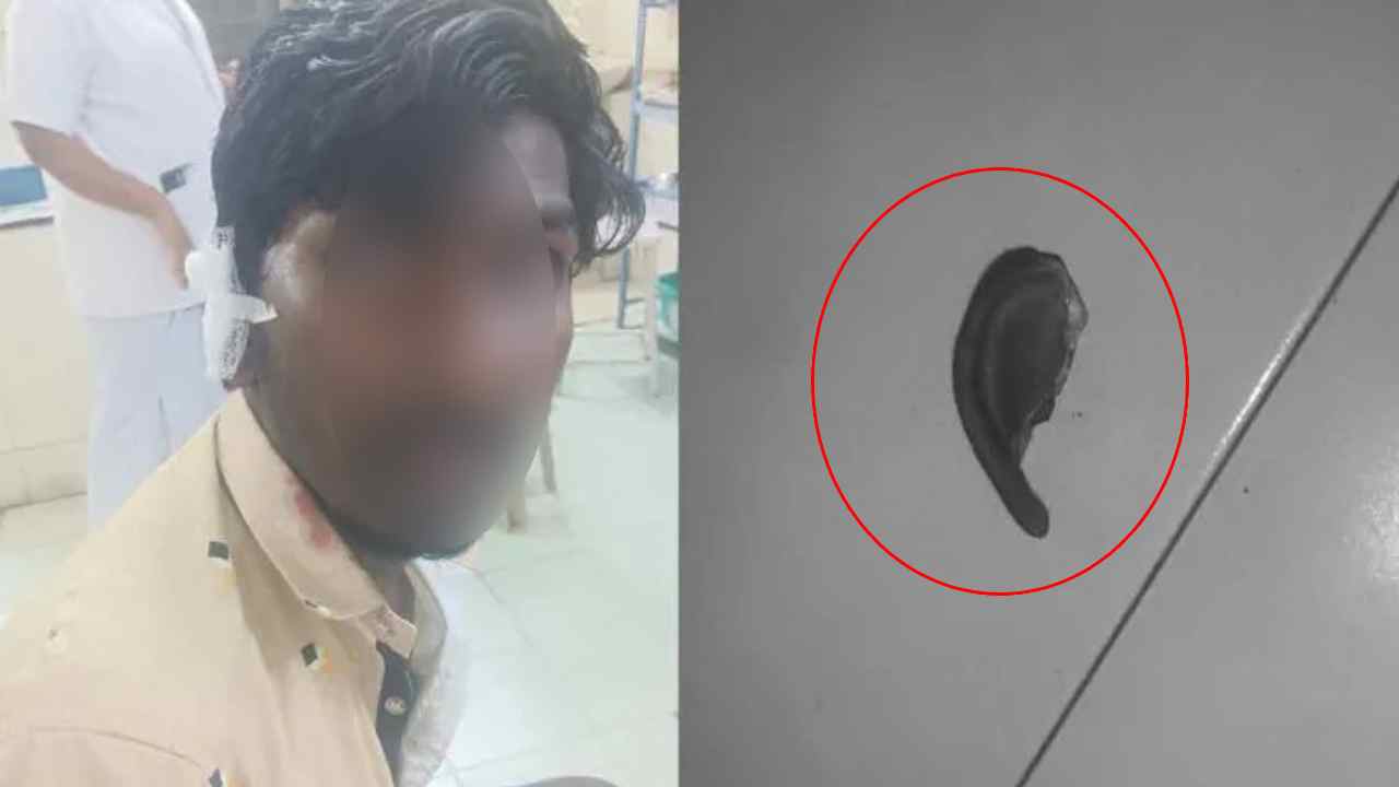 Andhra Pradesh : బాబాయ్ చెవి ఊడేలా కొరికేసిన అబ్బాయ్ Andhra Pradesh : బాబాయ్ చెవి ఊడేలా కొరికేసిన అబ్బాయ్