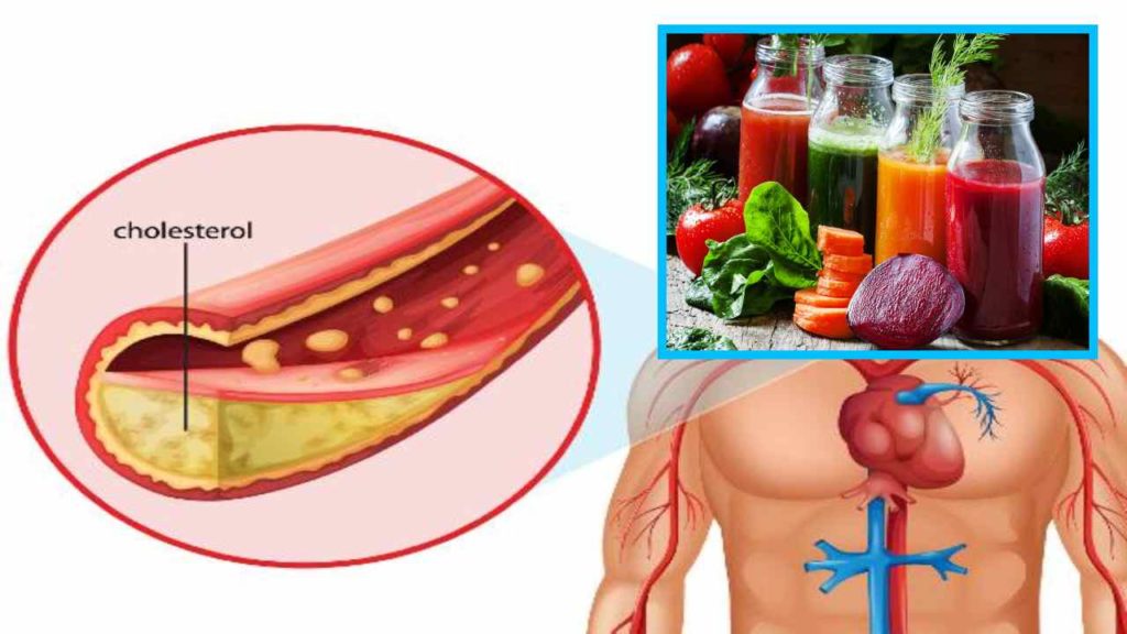 Cholesterol