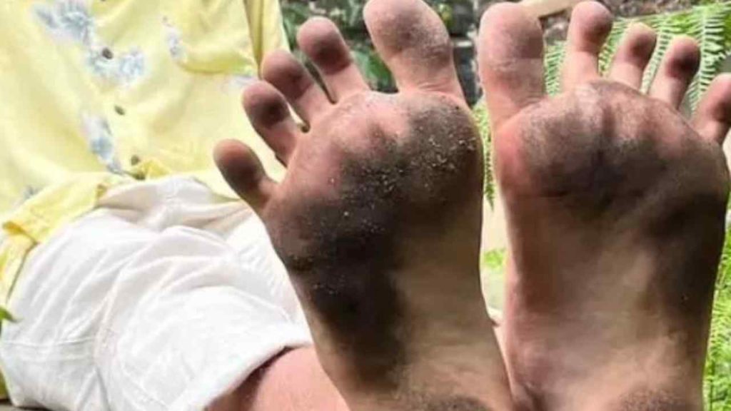 Foot