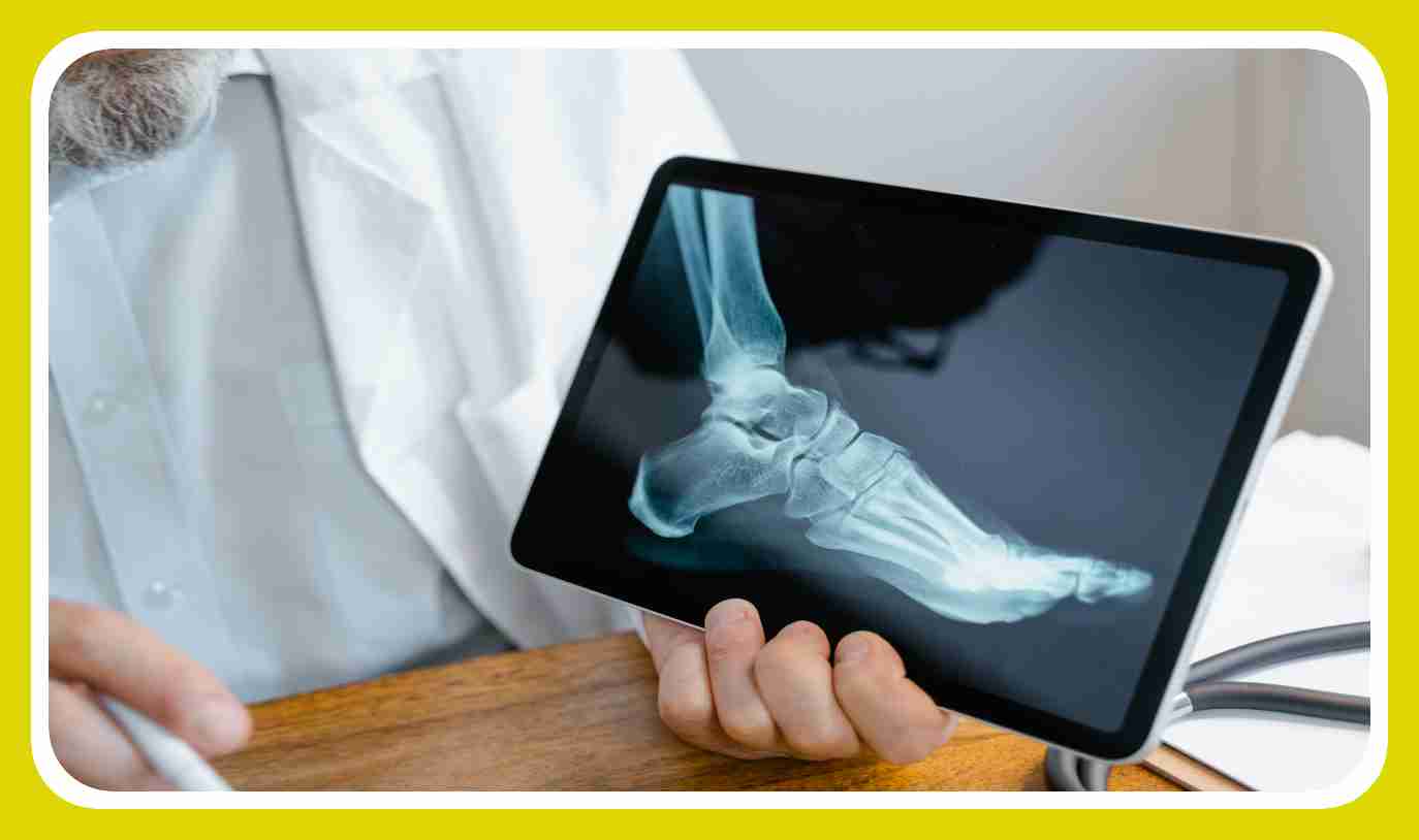 Bone Health : వయస్సు పైబడ్డవారిలో ఎముకల దృఢత్వం కోసం! Bone Health : వయస్సు పైబడ్డవారిలో ఎముకల దృఢత్వం కోసం!