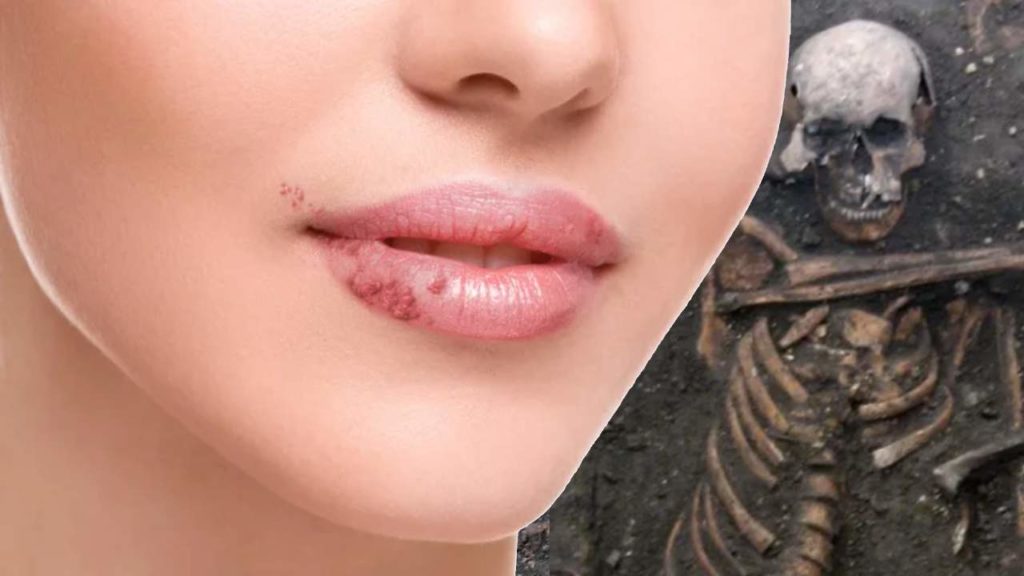 Lip Allergies