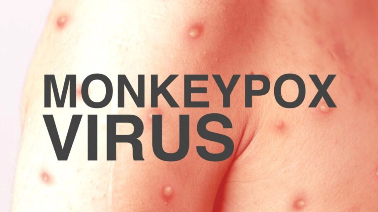 Monkeypox : ఉత్తర ప్రదేశ్లో రెండు అనుమానాస్పద మంకీపాక్స్ కేసులు Monkeypox : ఉత్తర ప్రదేశ్లో రెండు అనుమానాస్పద మంకీపాక్స్ కేసులు