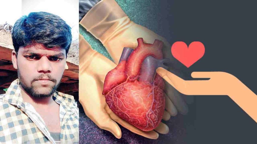 Organ Donation