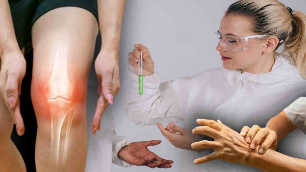Uric Acid