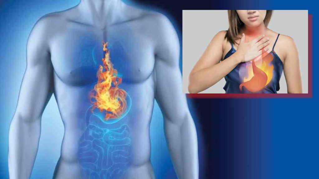 Acidity and Heartburn