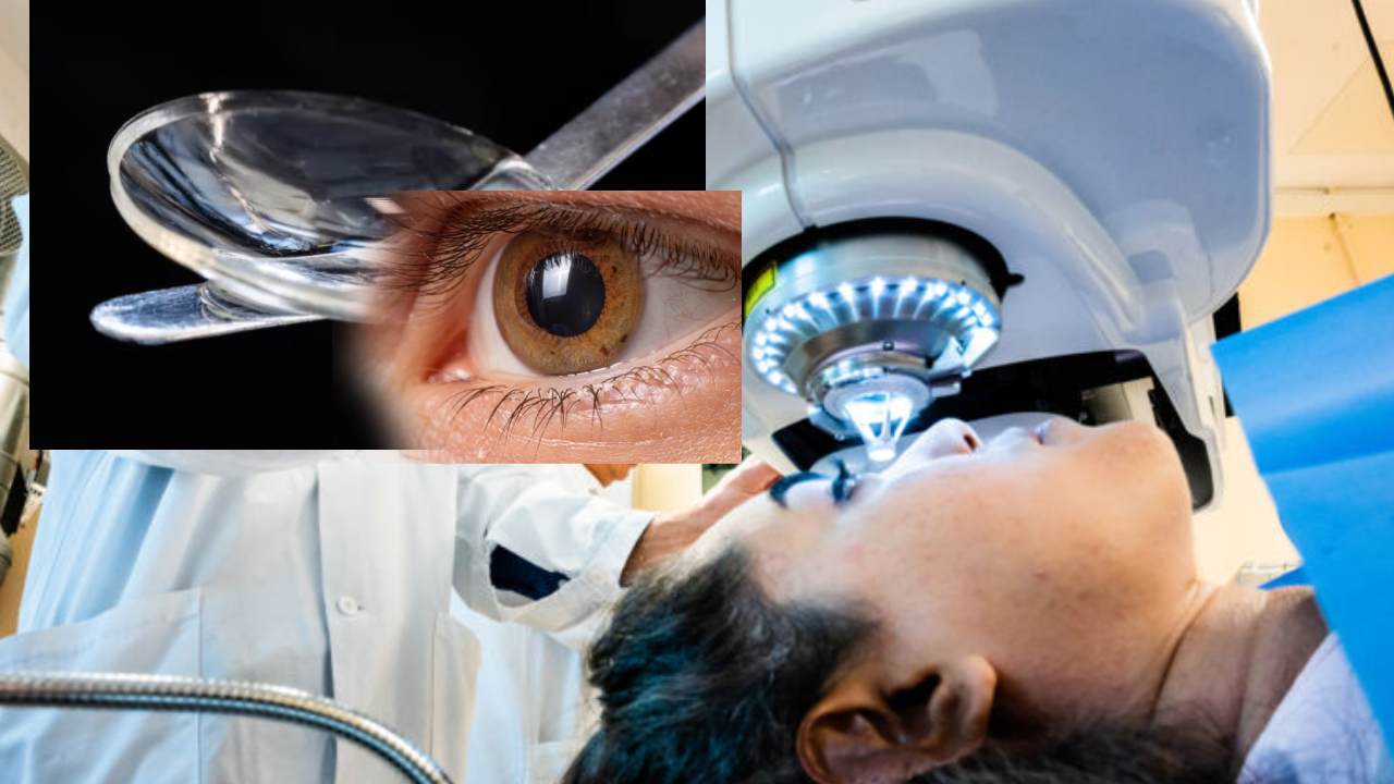 Cornea Implant From Pig Skin : పంది చర్మంతో కార్నియా చికిత్స..20 మందికి కంటిచూపు ప్రసాదించిన ఢిల్లీ ఎయిమ్స్ డాక్టర్లు Cornea Implant From Pig Skin : పంది చర్మంతో కార్నియా చికిత్స..20 మందికి కంటిచూపు ప్రసాదించిన ఢిల్లీ ఎయిమ్స్ డాక్టర్లు