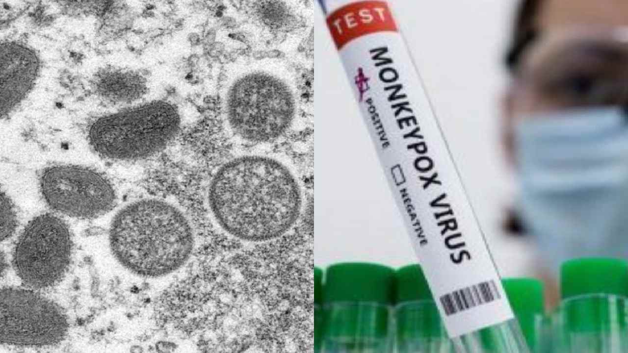 Delhi Monkey Pox : ఢిల్లీలో రెండో మంకీపాక్స్ కేసు Delhi Monkey Pox : ఢిల్లీలో రెండో మంకీపాక్స్ కేసు