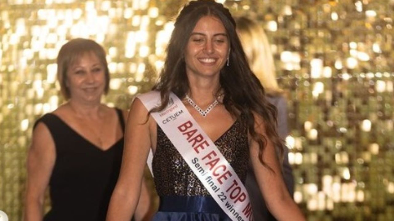 First Makeup-Free Contestant: మేకప్ వేసుకోకుండా మిస్ ఇంగ్లండ్ పోటీల్లో పాల్గొని అదరగొట్టిన అమ్మాయి First Makeup-Free Contestant: మేకప్ వేసుకోకుండా మిస్ ఇంగ్లండ్ పోటీల్లో పాల్గొని అదరగొట్టిన అమ్మాయి