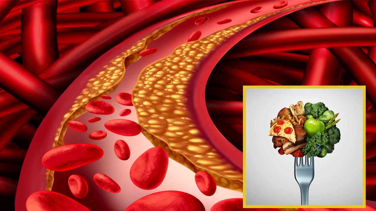 Bad Cholesterol : చెడు కొలెస్ట్రాల్ సమస్యతో బాధపడుతున్నారా? సమస్య నుండి బయటపడాలంటే ఈ చిట్కాలను పాటించి చూడండి! Bad Cholesterol : చెడు కొలెస్ట్రాల్ సమస్యతో బాధపడుతున్నారా? సమస్య నుండి బయటపడాలంటే ఈ చిట్కాలను పాటించి చూడండి!