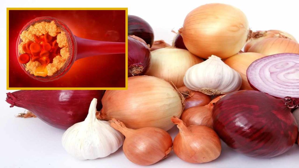 onion reduces Cholesterol