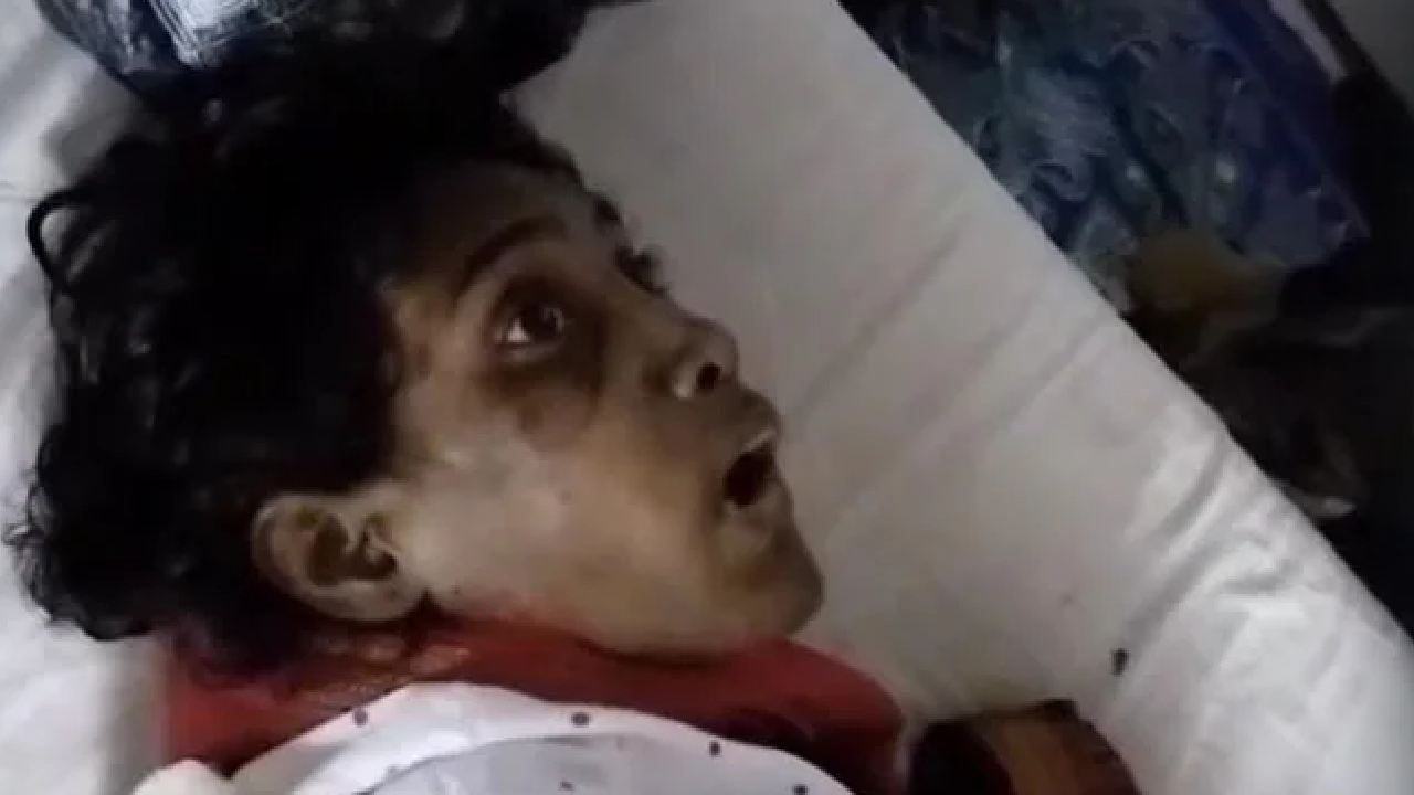 Tortured House Help: నాలుకతో టాయిలెట్ శుభ్రం చేయిస్తూ, యువతిని 8 ఏళ్ళుగా ఘోరంగా హింసించిన బీజేపీ నాయకురాలు.. అరెస్టు Tortured House Help: నాలుకతో టాయిలెట్ శుభ్రం చేయిస్తూ, యువతిని 8 ఏళ్ళుగా ఘోరంగా హింసించిన బీజేపీ నాయకురాలు.. అరెస్టు