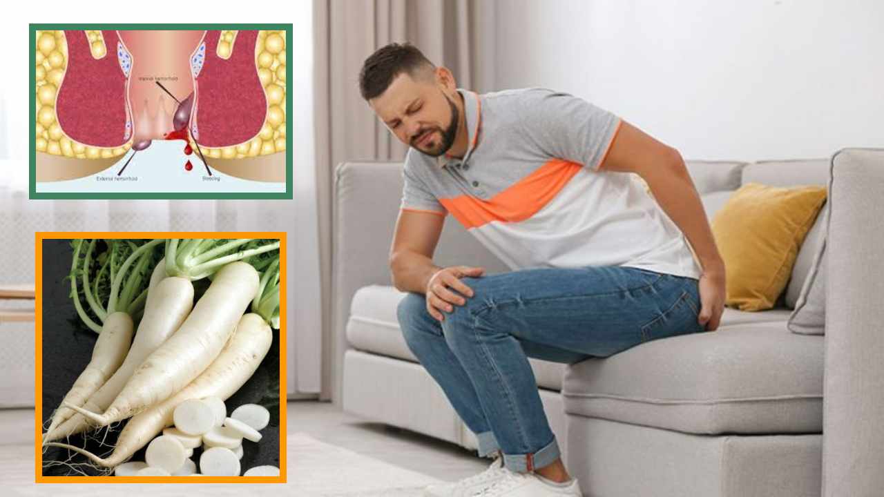 Piles Disease : మూల వ్యాధికి ముల్లంగితో పరిష్కారం! Piles Disease : మూల వ్యాధికి ముల్లంగితో పరిష్కారం!