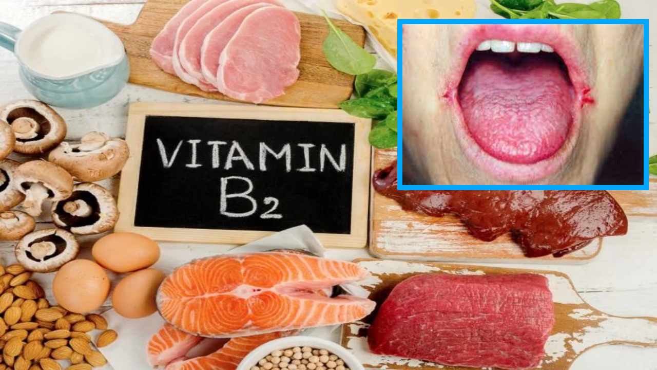 Vitamin B2 : విటమిన్ బి2 లోపం వల్ల కలిగే అనారోగ్య సమస్యలు ఇవే! Vitamin B2 : విటమిన్ బి2 లోపం వల్ల కలిగే అనారోగ్య సమస్యలు ఇవే!