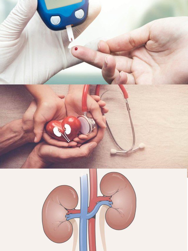 >మధుమేహంతో కిడ్నీలపై తీవ్ర ప్రభావం