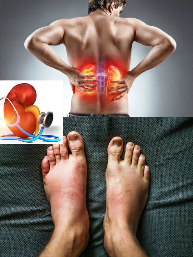 >కాళ్ల వాపులా..?