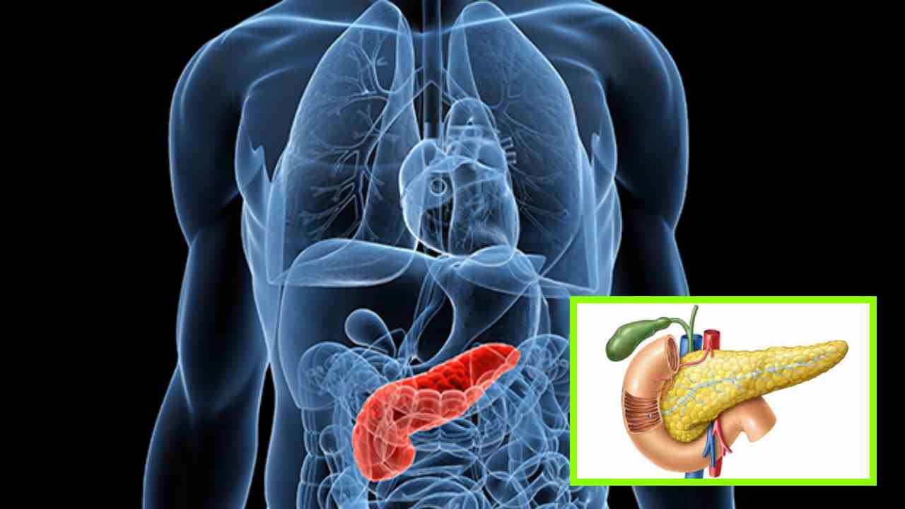 Pancreatitis Problem : ప్యాంక్రియాటైటిస్ అంటే ఏమిటి ? సమస్య తలెత్తితే కనిపించే లక్షణాలు ఇవే! Pancreatitis Problem : ప్యాంక్రియాటైటిస్ అంటే ఏమిటి ? సమస్య తలెత్తితే కనిపించే లక్షణాలు ఇవే!
