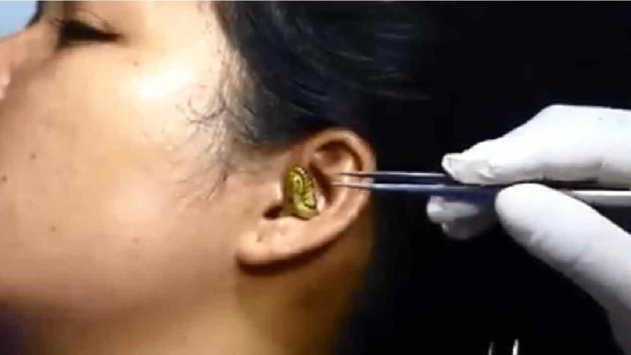 Snake Gets Stuck In Ear: అమ్మాయి చెవిలో దూరిన సన్నపాటి పాము..? వీడియో వైరల్ Snake Gets Stuck In Ear: అమ్మాయి చెవిలో దూరిన సన్నపాటి పాము..? వీడియో వైరల్