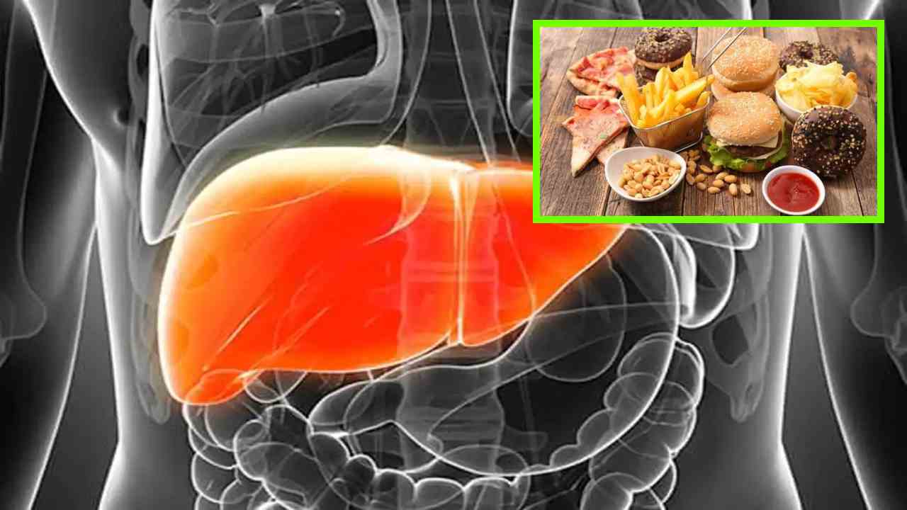 Avoid Liver Damage : కాలేయానికి పెనుముప్పును తెచ్చిపెట్టే గతి తప్పిన జీవనశైలి! కాలేయం దెబ్బతినకుండా నివారించాల్సిన హానికరమైన అలవాట్లు ఇవే? Avoid Liver Damage : కాలేయానికి పెనుముప్పును తెచ్చిపెట్టే గతి తప్పిన జీవనశైలి! కాలేయం దెబ్బతినకుండా నివారించాల్సిన హానికరమైన అలవాట్లు ఇవే?