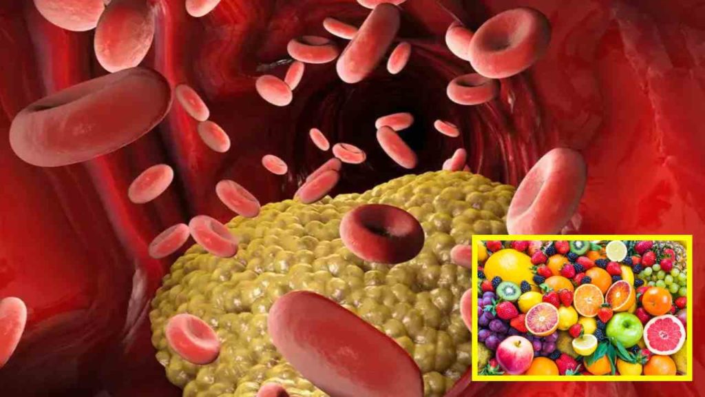 cholesterol problem should include 5 types of fruits in their diet