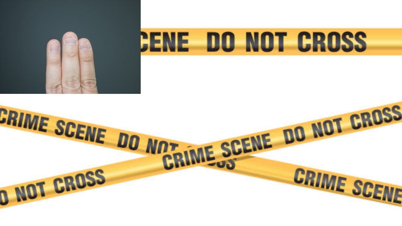 Woman bites fingers: టీవీ సౌండు తగ్గించాలని చెప్పినందుకు అత్త చేతి మూడు వేళ్ళు కొరికేసిన కోడలు Woman bites fingers: టీవీ సౌండు తగ్గించాలని చెప్పినందుకు అత్త చేతి మూడు వేళ్ళు కొరికేసిన కోడలు