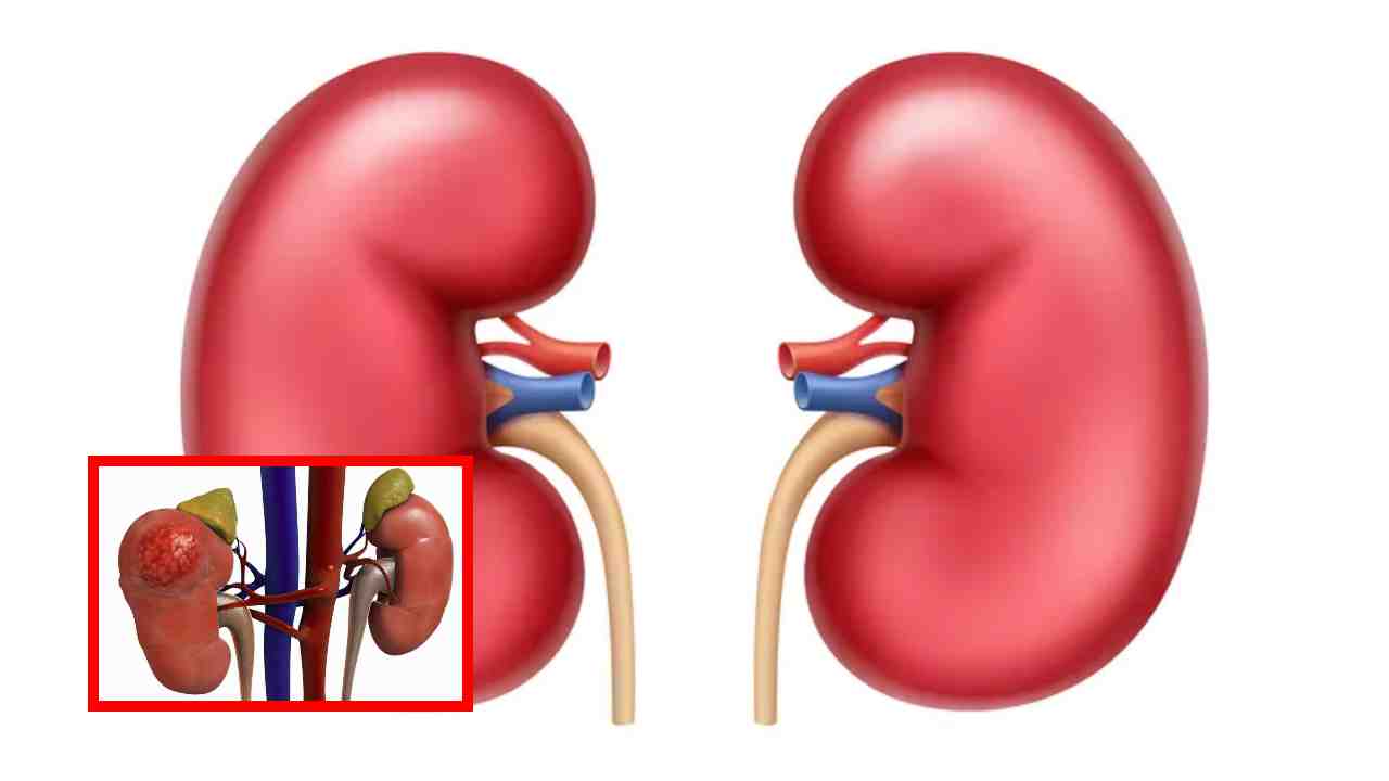 Kidneys : ఈ లక్షణాలు కనిపిస్తే డాక్టర్ ను సంప్రదించటం మంచిది? Kidneys : ఈ లక్షణాలు కనిపిస్తే డాక్టర్ ను సంప్రదించటం మంచిది?