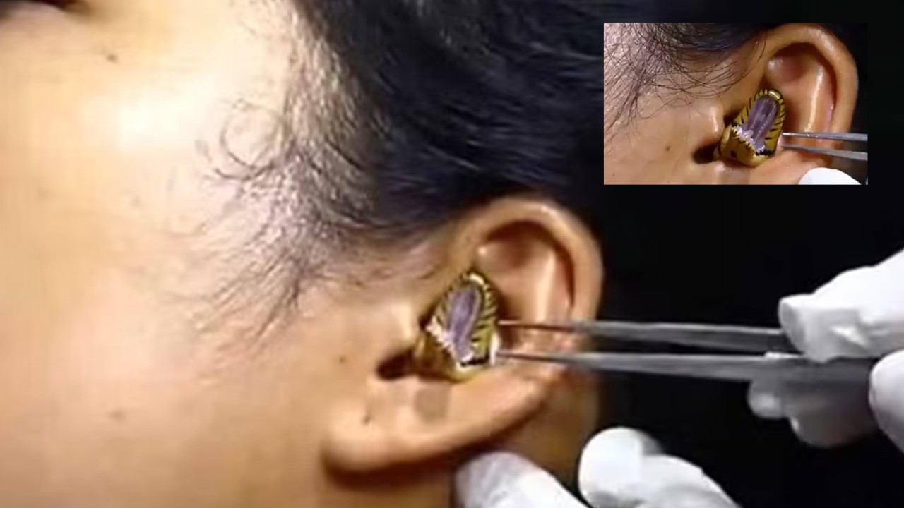 Snake In Woman Ear : మహిళ చెవిలోకి దూరిన పాము Snake In Woman Ear : మహిళ చెవిలోకి దూరిన పాము
