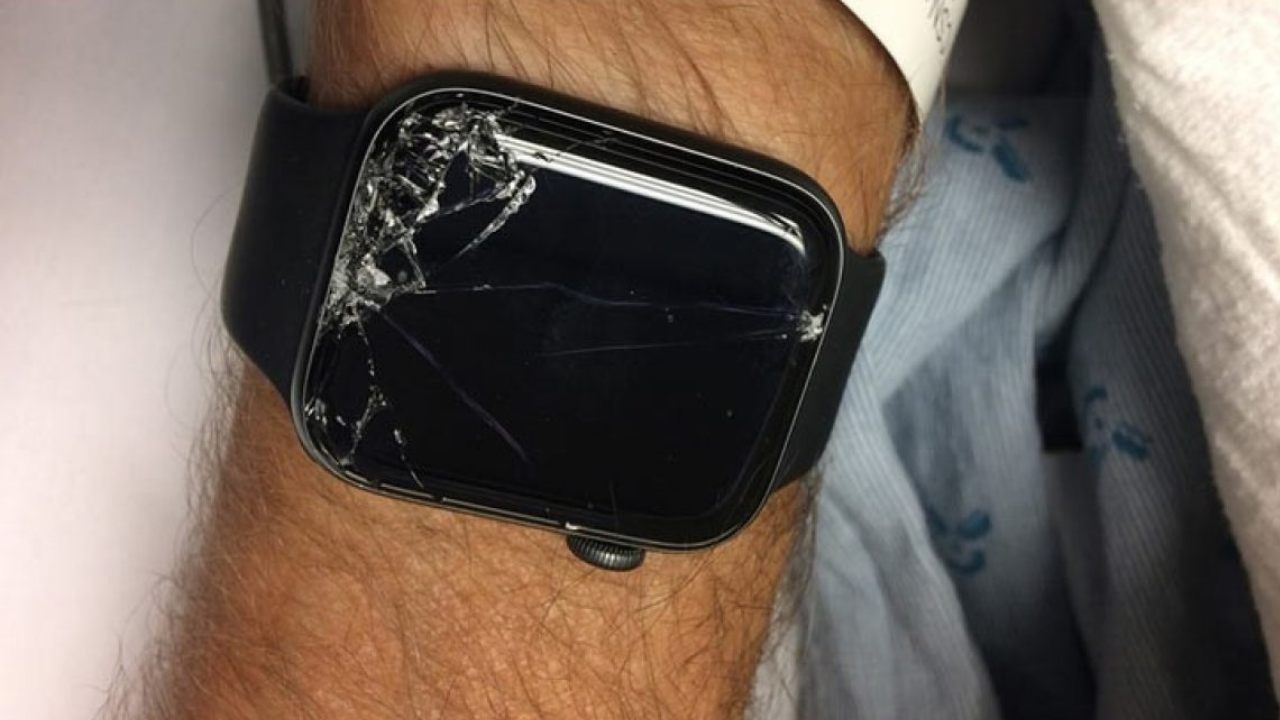 Apple Watch Series 7 explodes, sends man hurrying to hospital