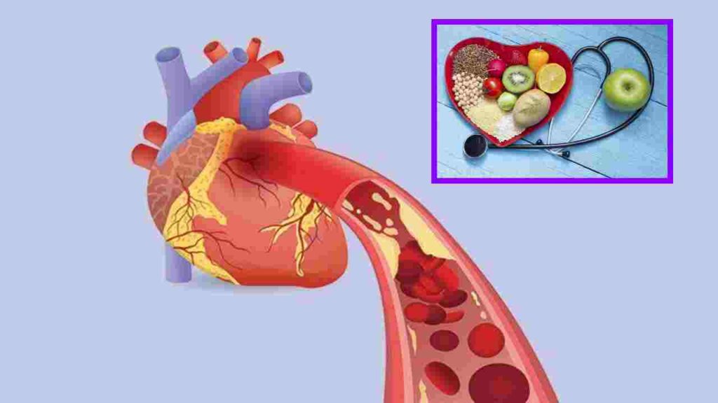 Are high triglyceride levels a risk factor for heart attack?