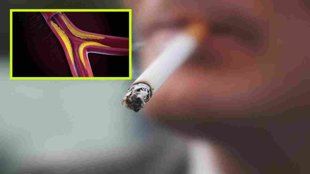 Does cigarette smoke increase cholesterol in the body?
