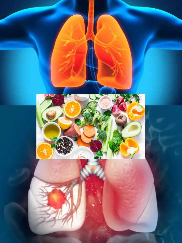 >ఊపిరితిత్తుల క్యాన్సర్ దరిచేరకుండా ఉండాలంటే ఆరోగ్యకరమైన అలవాట్లే ముఖ్యం! ఊపిరితిత్తుల ఆరోగ్యం కోసం ఈ ఆహారాలు తీసుకోవటం మేలు!