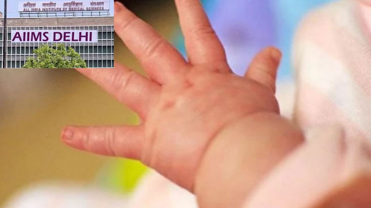 Rare Incident In Delhi AIIMS : ఏడు నెలలుగా అపస్మారకస్థితిలోనే మహిళ.. ఆడబిడ్డకు జననం Rare Incident In Delhi AIIMS : ఏడు నెలలుగా అపస్మారకస్థితిలోనే మహిళ.. ఆడబిడ్డకు జననం