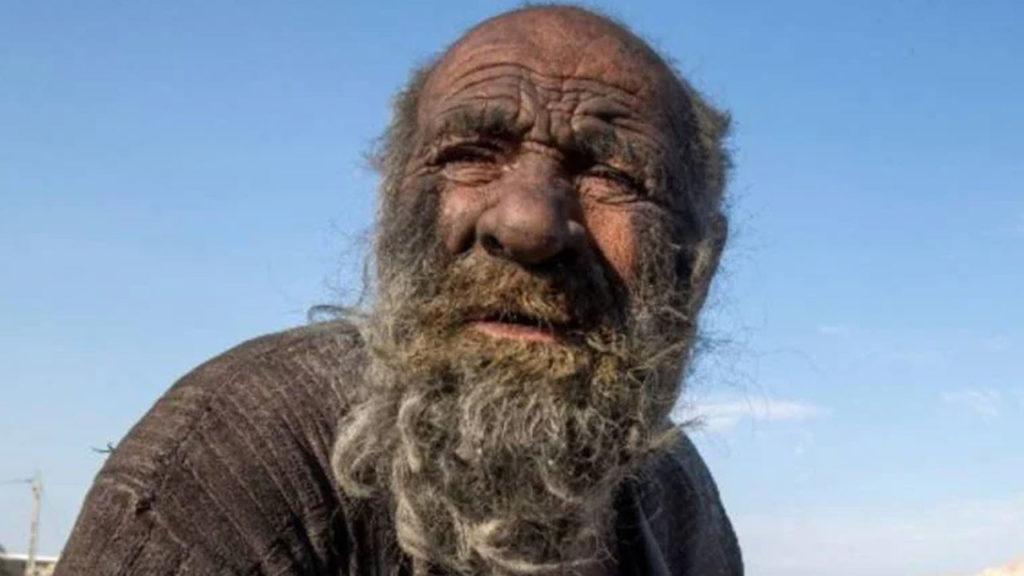 World's dirtiest man dies in Iran at 94