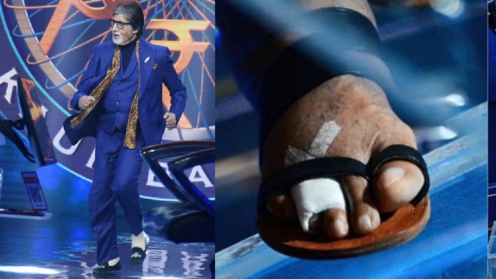 Amithab Bachchan leg injury but participated in shoot