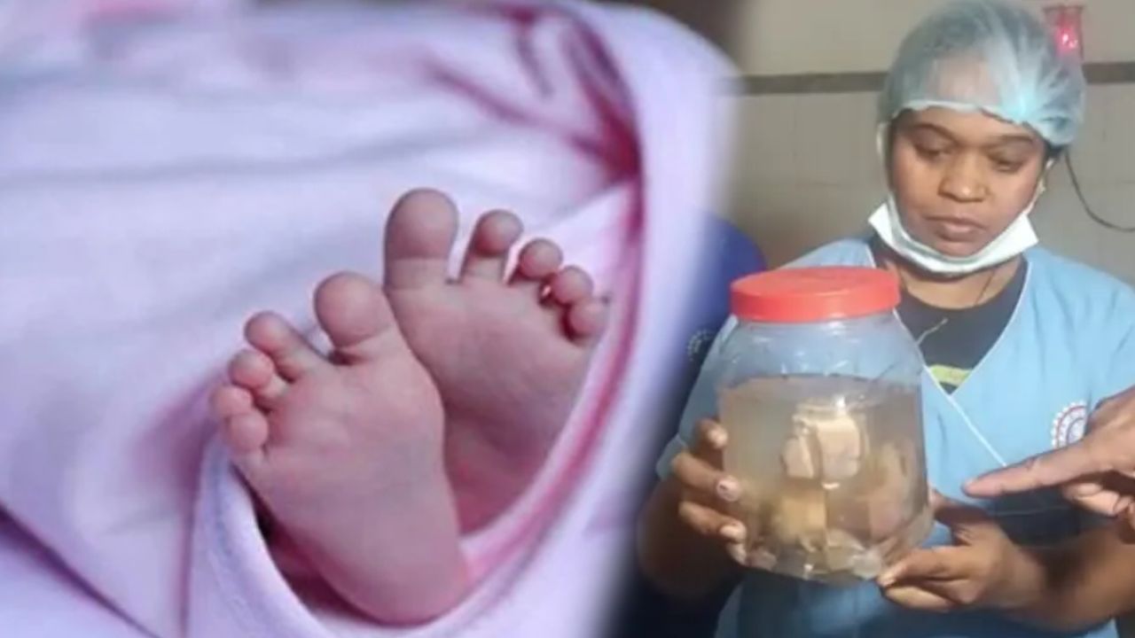 8 Fetuses in Stomach : 21 రోజుల ఆడశిశువు కడుపులో 8 పిండాలు..! ఝార్ఖండ్లో ప్రపంచంలోనే అరుదైన ఘటన..! 8 Fetuses in Stomach : 21 రోజుల ఆడశిశువు కడుపులో 8 పిండాలు..! ఝార్ఖండ్లో ప్రపంచంలోనే అరుదైన ఘటన..!