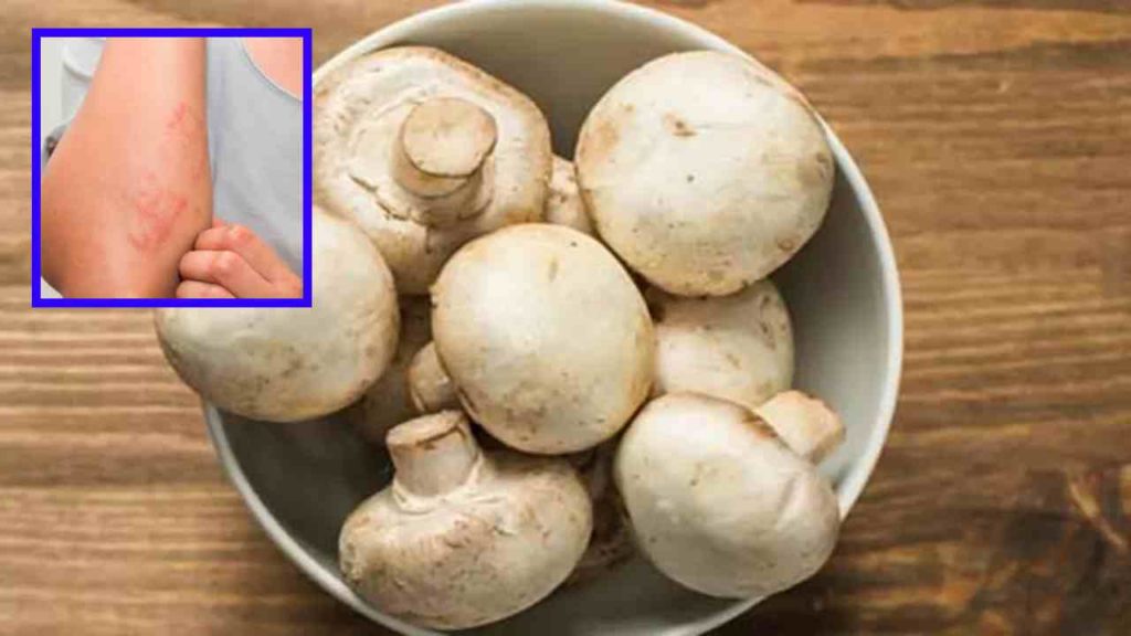 Eating too many mushrooms? Risk of skin problems!