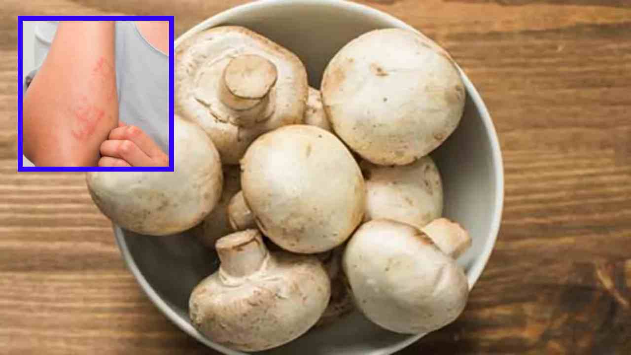 Mushrooms : పుట్టగొడుగులను అతిగా తింటున్నారా? చర్మ సంబంధిత సమస్యలు వచ్చే ప్రమాదం! Mushrooms : పుట్టగొడుగులను అతిగా తింటున్నారా? చర్మ సంబంధిత సమస్యలు వచ్చే ప్రమాదం!